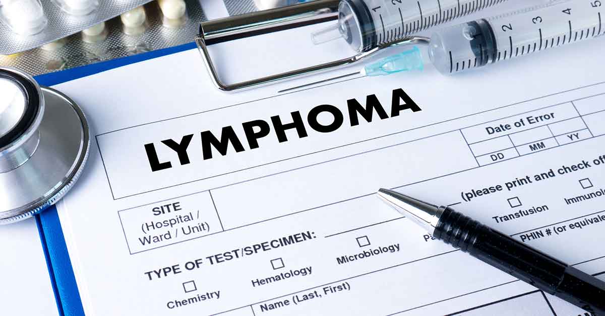 Lymphoma