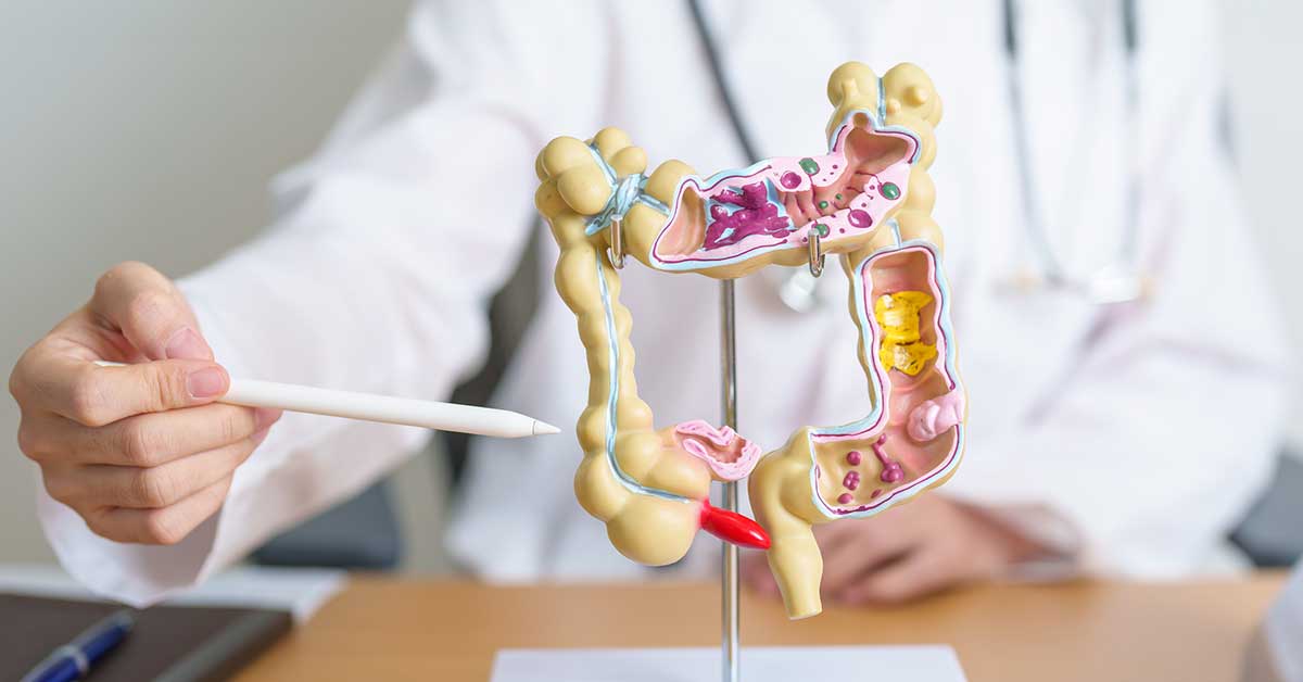 Doctor with human Colon anatomy model