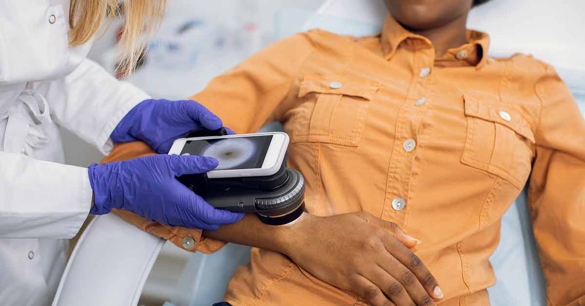 Dark skin woman having skin mole examined by doctor