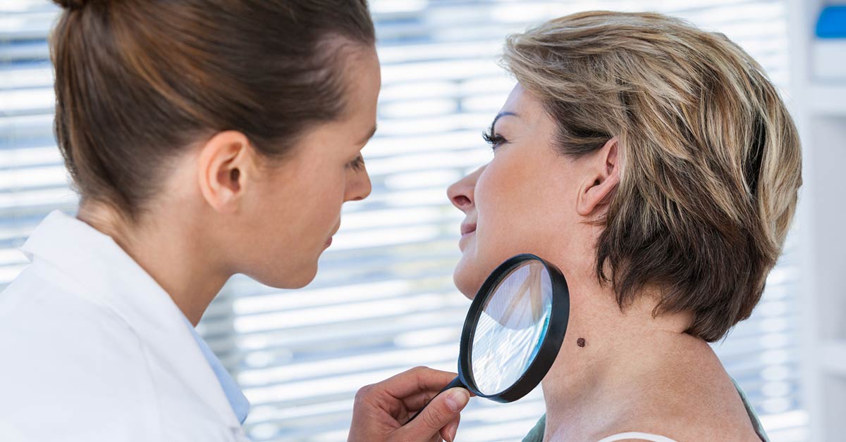 Woman with Skin Cancer Mole