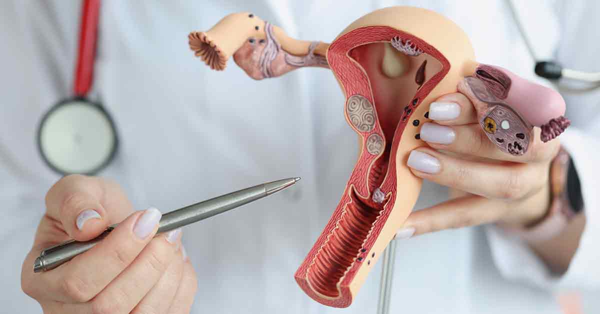 model of female reproductive organs