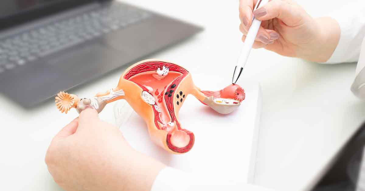 Photo of female reproductive system plastic model